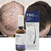 FEG Plus Hair Growth Spray before and after comparison showing improved hair density appearance