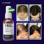 FEG Plus Hair Growth Spray customer before and after hair growth results for men and women