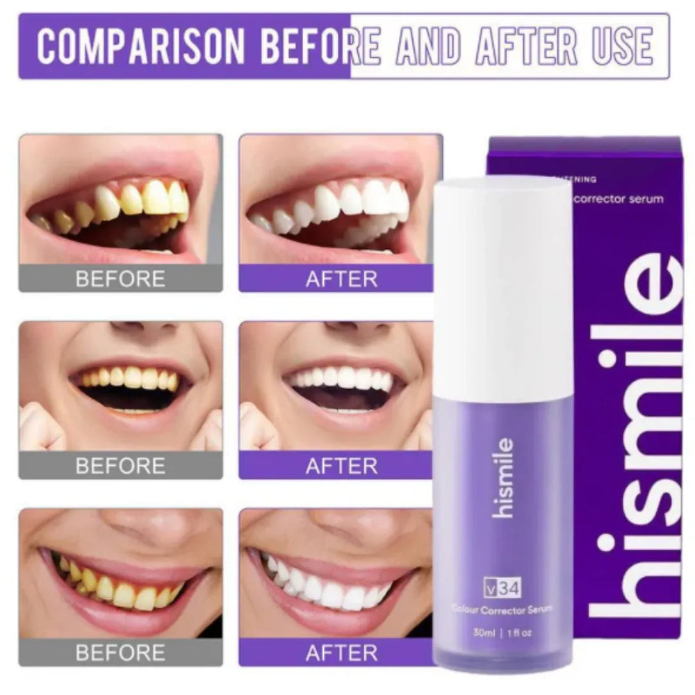 Hismile Teeth Whitening V34 Color Corrector Serum