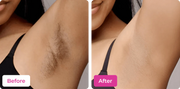 Side-by-side before and after comparison of a woman's underarm hair removal, showing noticeable underarm hair versus smooth, clean skin after using Meeoow Club hair removal mask.