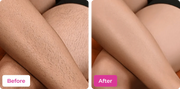 Side-by-side before and after comparison of leg hair removal using Meeoow Club body hair mask, showing legs with short, visible hair stubble vs completely smooth, hairless skin.