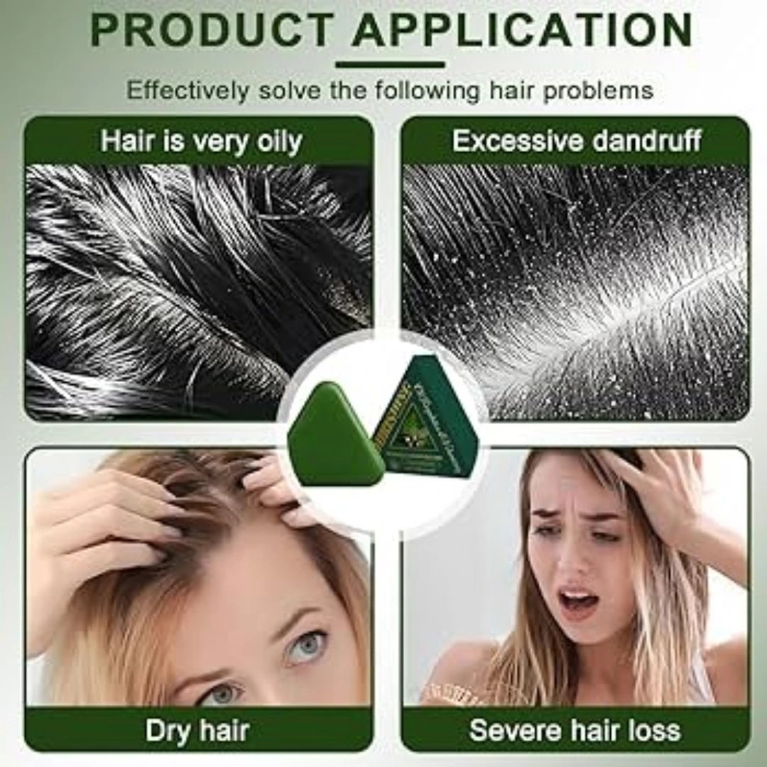 Nature Seven Green Shampoo Bar for oily hair dandruff dry hair and hair fall solution
