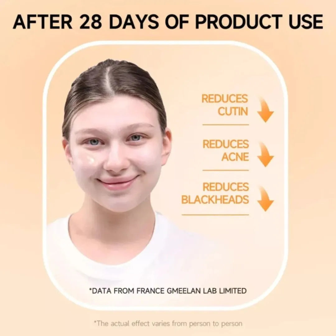Orange Enzyme Exfoliating Brightening Gel for Acne Blackheads and Smooth Clear Skin After Use