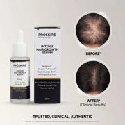 ProSkire Intense Hair Growth Serum before and after hair density comparison showing improved scalp coverage and fuller-looking hair with consistent use. Results may vary by individual.