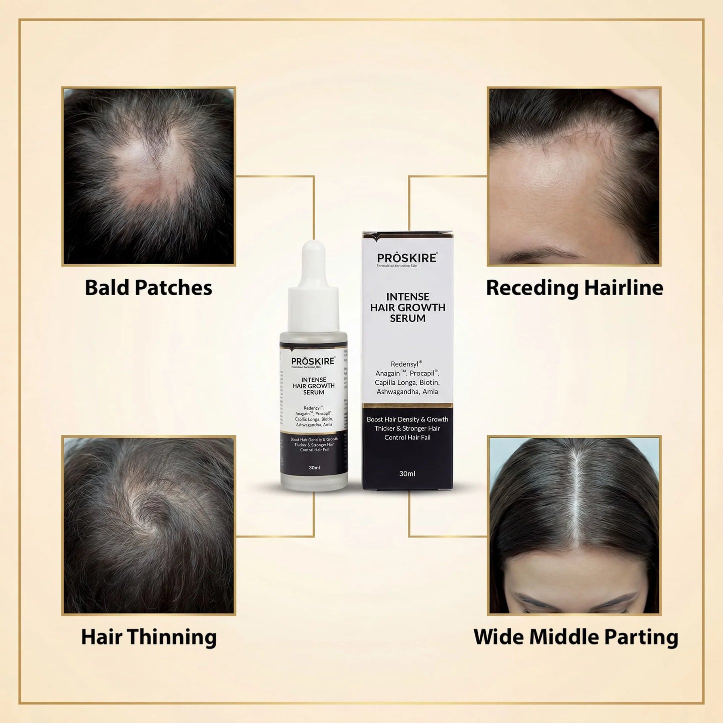 ProSkire Intense Hair Growth Serum for hair thinning, bald patches, receding hairline and wide middle parting, helping support thicker, healthier-looking hair for men and women