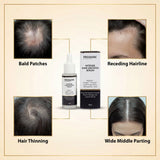 ProSkire Intense Hair Growth Serum for hair thinning, bald patches, receding hairline and wide middle parting, helping support thicker, healthier-looking hair for men and women