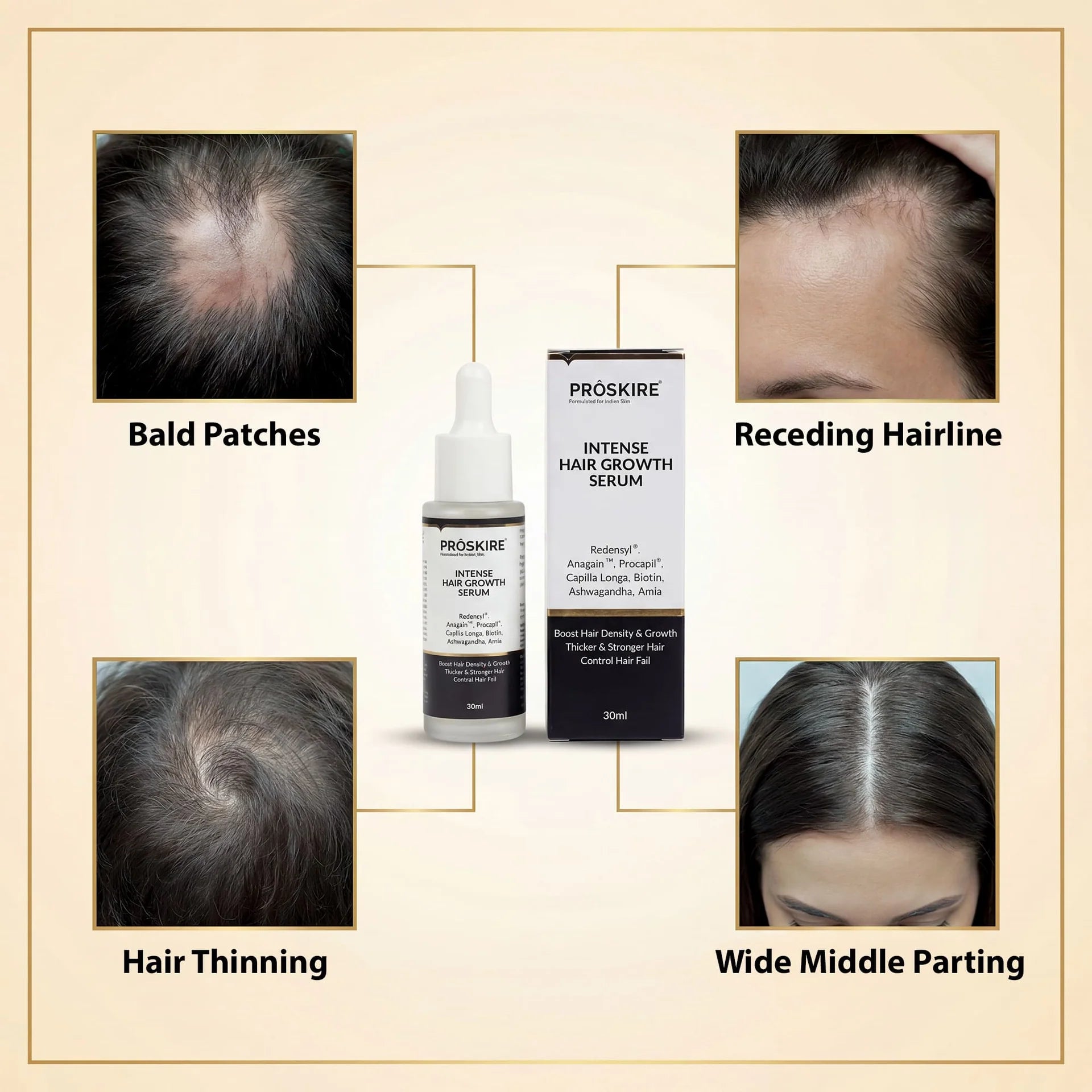ProSkire Intense Hair Growth Serum for hair thinning, bald patches, receding hairline and wide middle parting, helping support thicker, healthier-looking hair for men and women