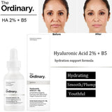 The Ordinary Hyaluronic Acid 2% + B5 serum before and after skin hydration results