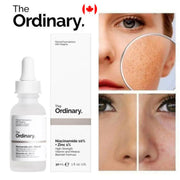 The Ordinary Niacinamide 10% + Zinc 1% serum for pores acne scars and smooth skin